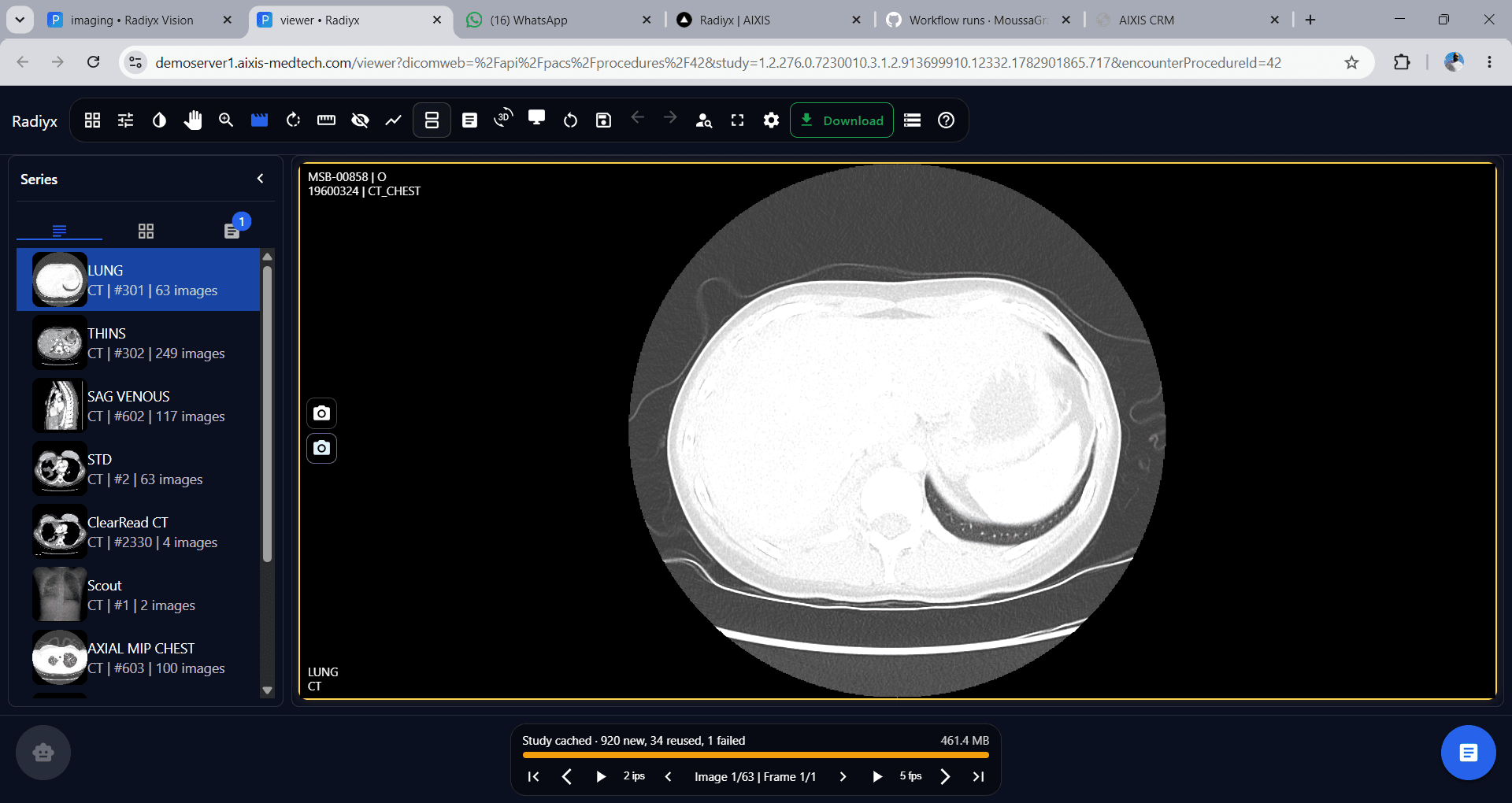 Radiyx View screenshot