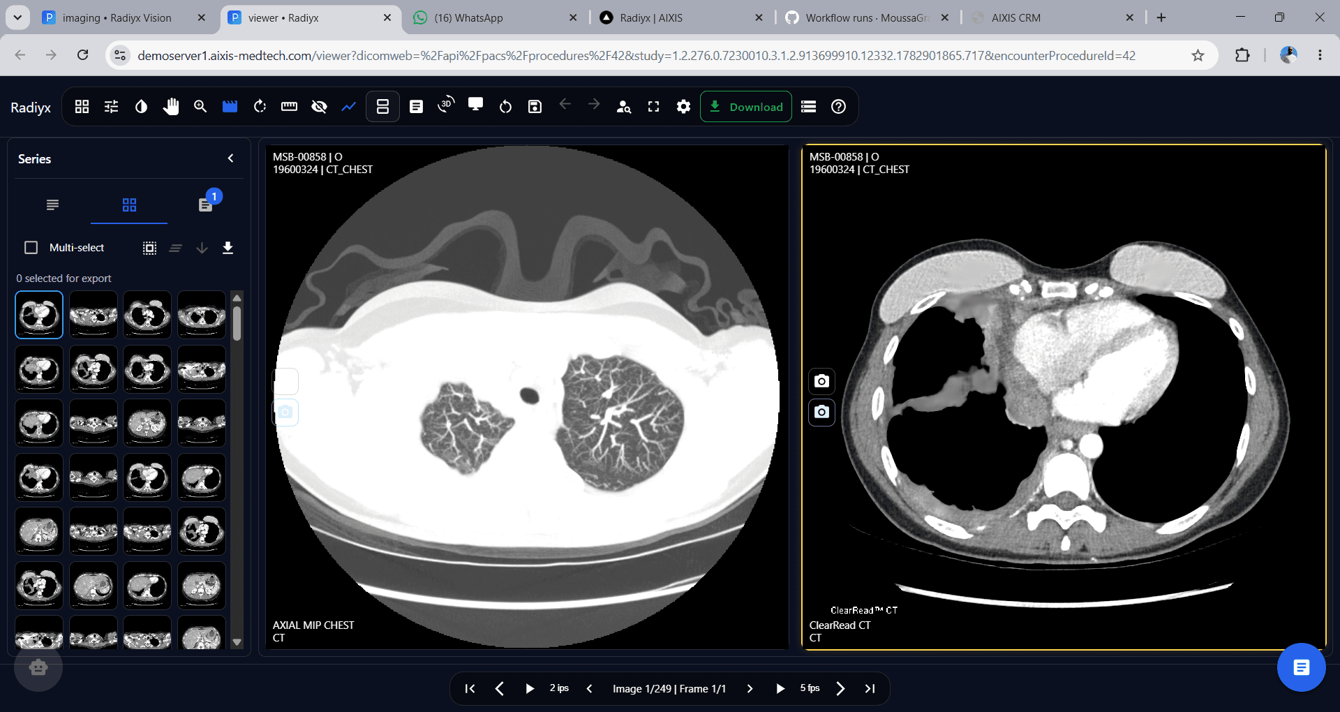 Radiyx View screenshot