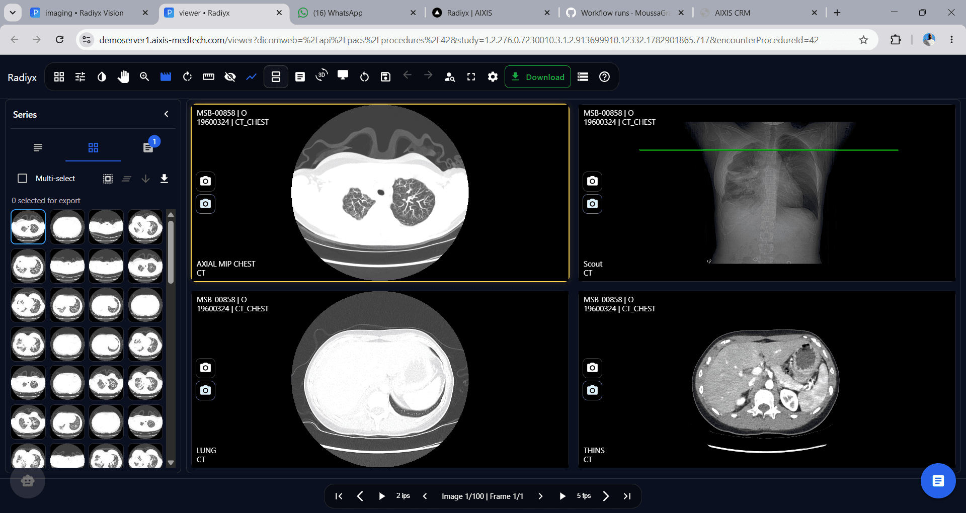 Radiyx View screenshot
