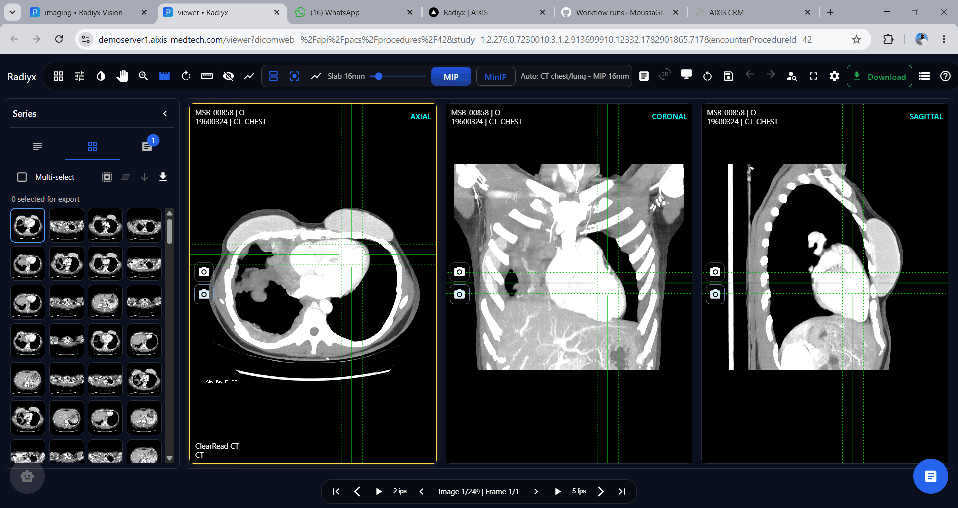 Radiyx View screenshot
