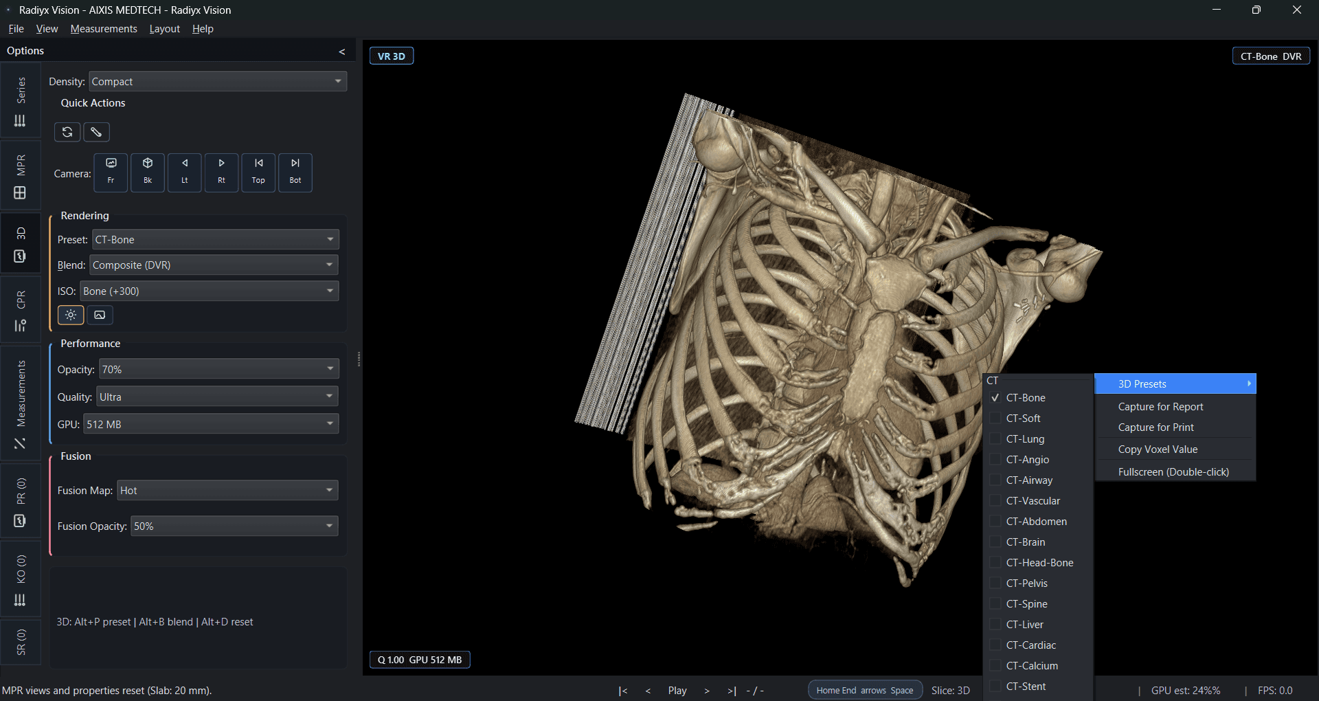 Radiyx Vision interface screenshot