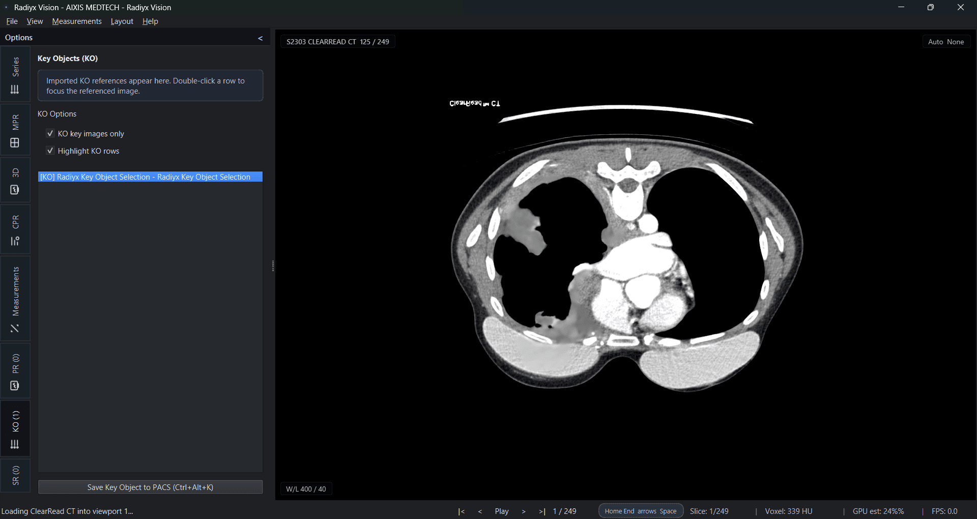 Radiyx Vision interface screenshot
