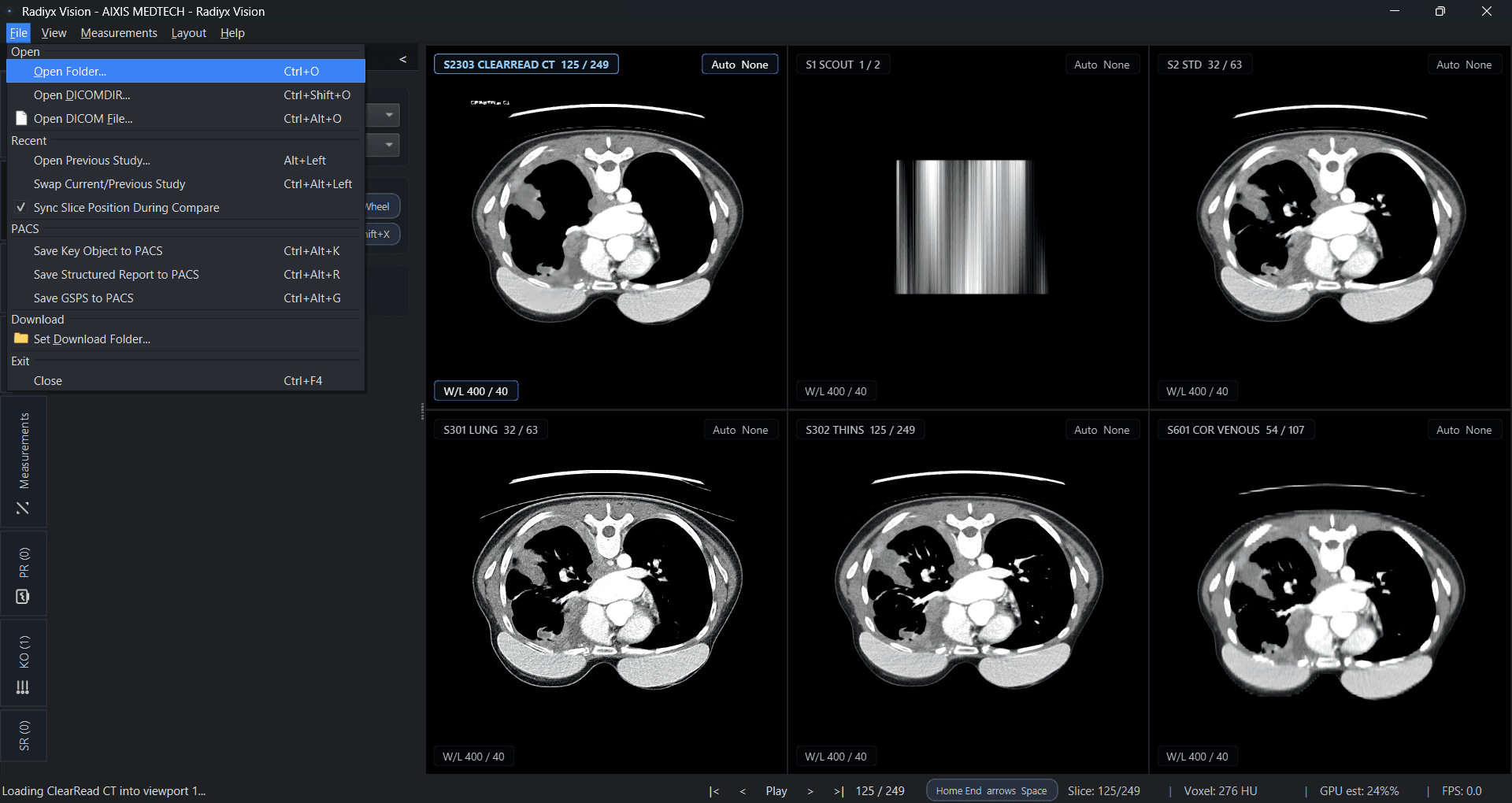 Radiyx Vision interface screenshot