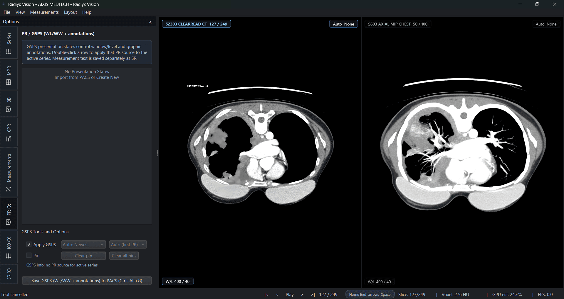 Radiyx Vision interface screenshot