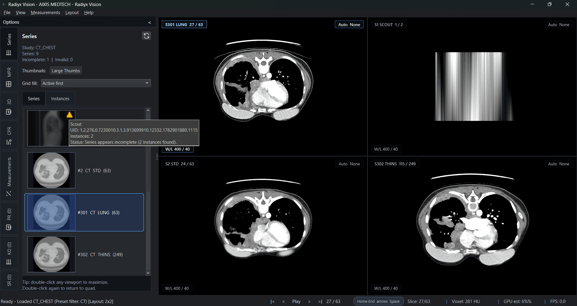 Radiyx Vision interface screenshot